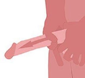 Kesilgan jinsiy olatni Kesilgan jinsiy olatni